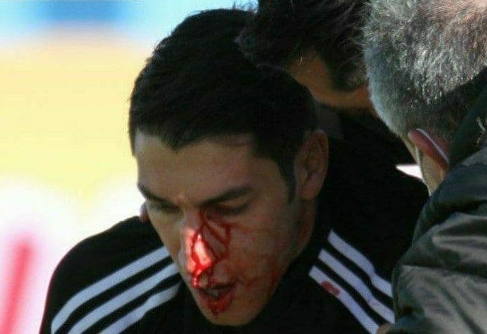 آخرین وضعیت مصدومیت سنگربان تراکتور/ اخباری بعد از پایان فصل جراحی می‌کند