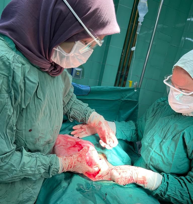 توده ۱۰ کیلویی از بدن دختر ۲۱ ساله در تبریز خارج شد+ عکس