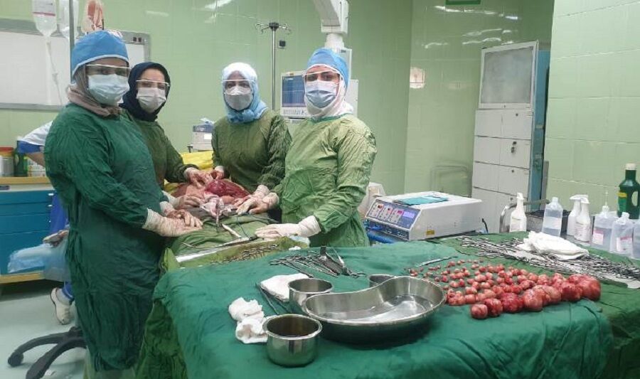 ۹۷ توده رحمی از شکم بانوی ۴۲ ساله تبریزی خارج شد
