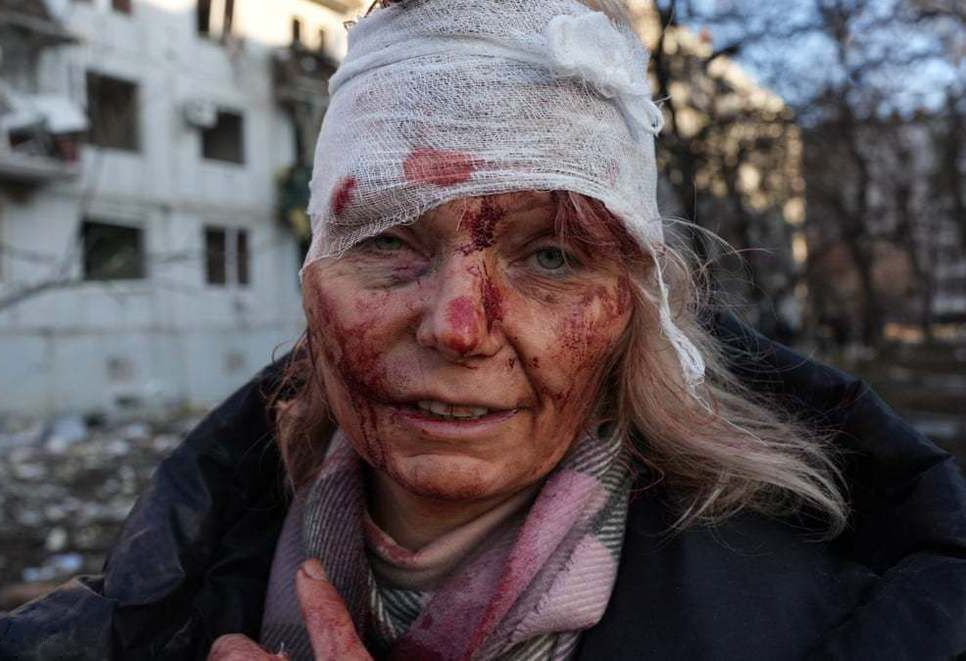 تصاویر بحران روسیه و اوکراین در یک نگاه