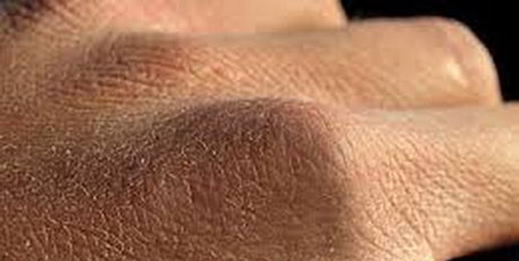 چگونه از خشکی پوست در فصل پاییز بکاهیم؟