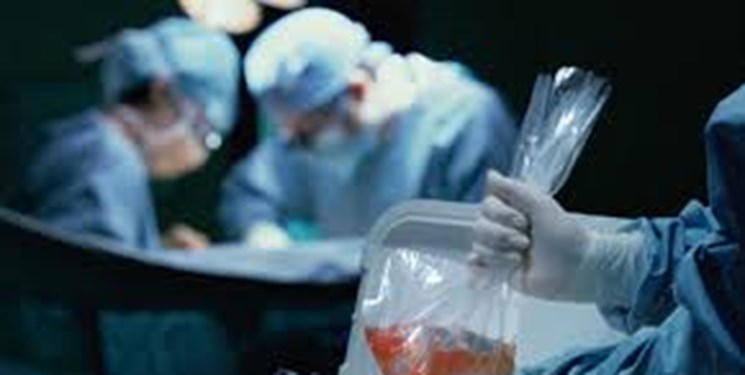 1521 مورد عمل‌ پیوند عضو در تبریز