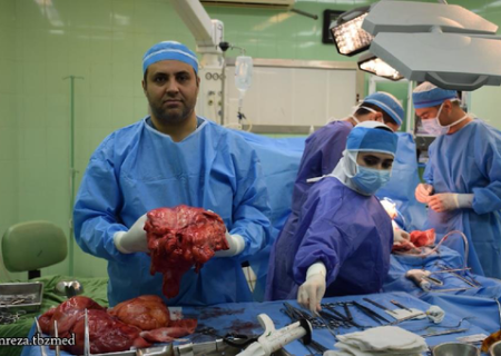 خارج کردن توده ۲۰ کیلویی از شکم مرد ۶۵ ساله در تبریز