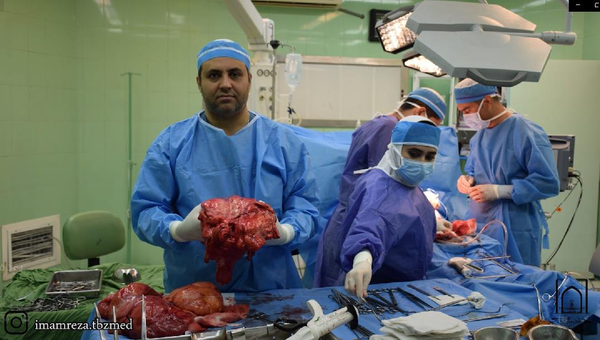 خارج کردن توده ۲۰ کیلویی از شکم مرد ۶۵ ساله در تبریز