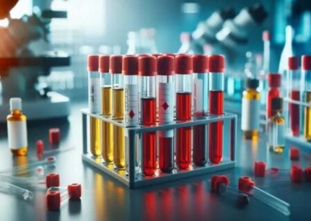 کمبود ذخایر خون در آذربایجان شرقی